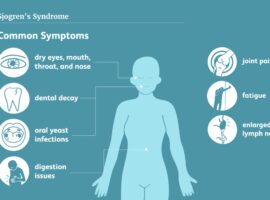 Dosen FK IPB University Ajak Masyarakat Waspadai Bahaya Sjogren’s Syndrome