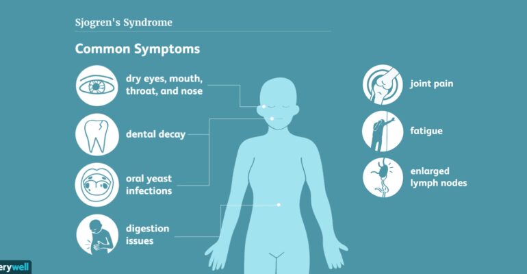 Dosen FK IPB University Ajak Masyarakat Waspadai Bahaya Sjogren’s Syndrome