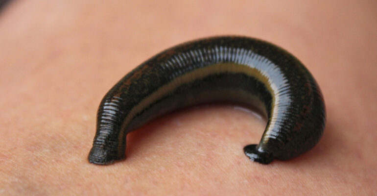 Dosen Fakultas Kedokteran IPB University Ungkap Manfaat dan Risiko Hirudoterapi dalam Dunia Medis Modern