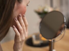 Ilustrasi kulit kusam (freepik)