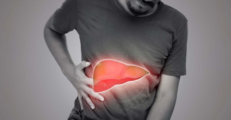 fatty-liver-mulai-intai-usia-30-an-dosen-fkgiz-ipb-university-ingatkan-pentingnya-perbaikan-gaya-hidup.jpg