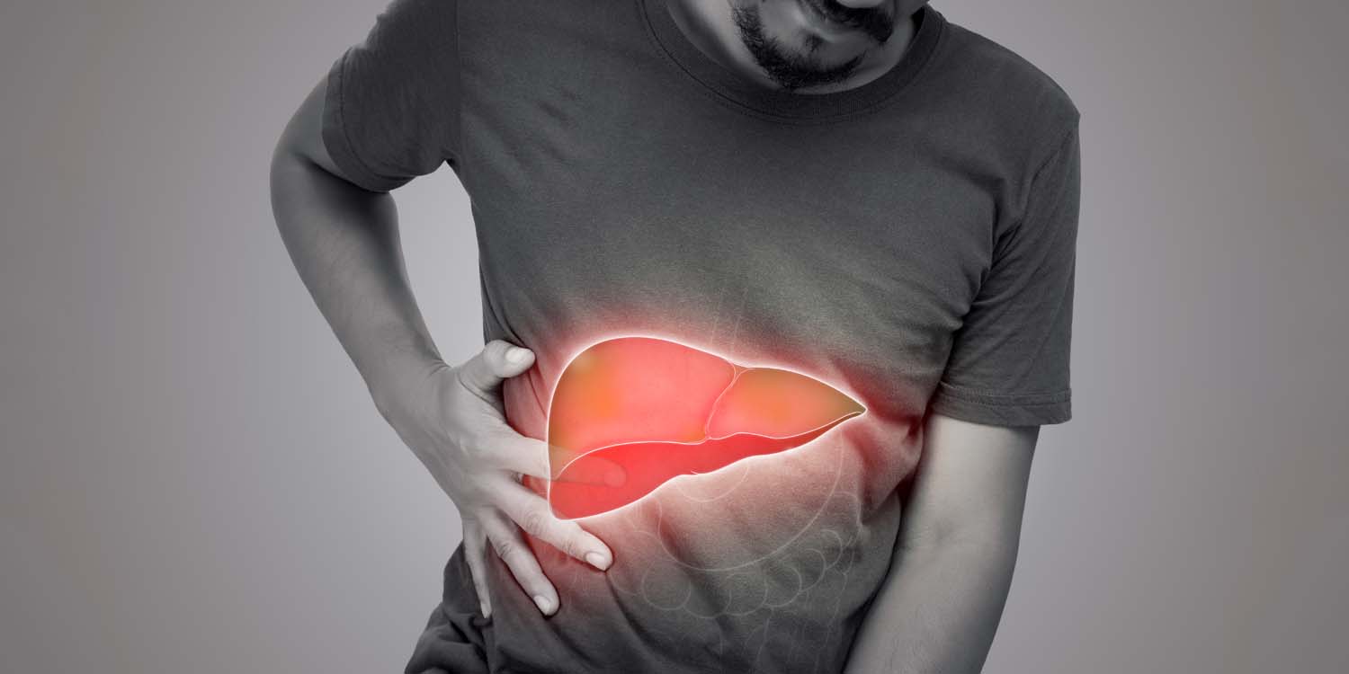 Fatty Liver Mulai Intai Usia 30-an, Dosen FKGiz IPB University Ingatkan Pentingnya Perbaikan Gaya Hidup